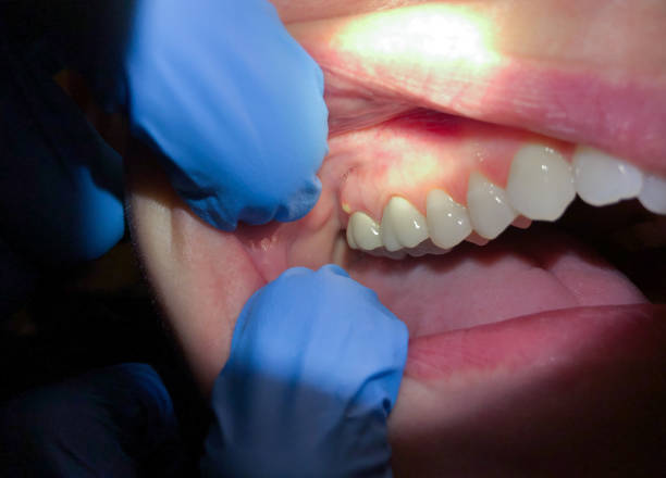 Best Emergency Treatment for Toothache in Quantico Base, VA